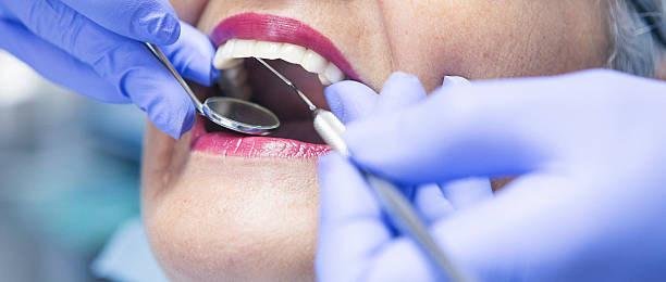 Best Emergency Dental Care for Sports Injuries in Tiburon, CA